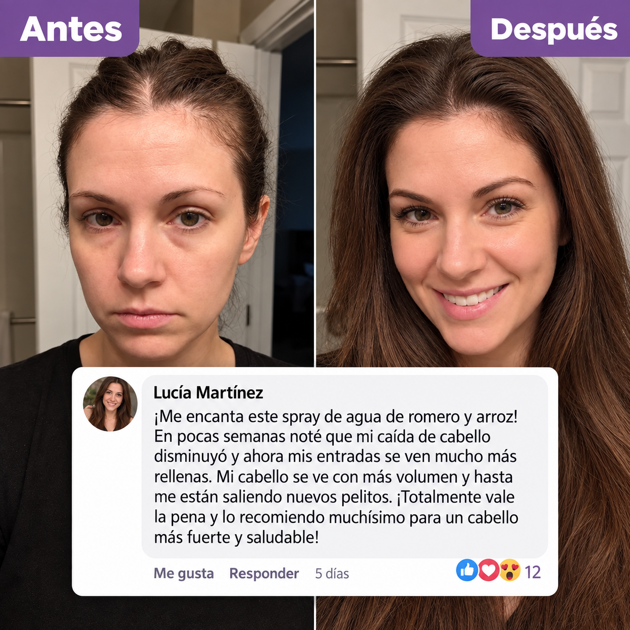 Spray Anticaida de Pelo Bare Anatomy